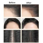 Conceals Black Hairline Powder 1 Pcs