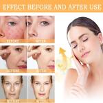 Skin Whitening Soap  For Men and Women  (pack of 1).