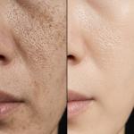 Skin Whitening Soap  For Men and Women  (pack of 1).