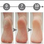 Stainless Steel Rasp Callus File Blade Foot for Wet and Dry Feet (Pack of 1, Black)