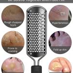 Stainless Steel Rasp Callus File Blade Foot for Wet and Dry Feet (Pack of 1, Black)