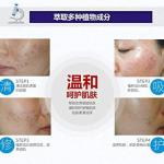 Whitening Moisturizing Skin Care Pimple Removal Cream (Pack of 1)