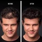 Hair Building And Thickening Fibers for Natural Looking Hairs, Hair Loss Concealing Fillers for Instant Thickening of Thinning, Balding Hair.