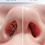 2 Pcs Nose Hair Remover Cutter, 2-in-1 Nasal Hair Cutter