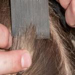 Hair Combs for Head Lice, Nit & Egg Removal with Long Fine Metal (Pack of 1)