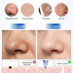 Multi-function Whitehead & Blackhead Remover Tool | Electric Device Machine |(Pack of 1).
