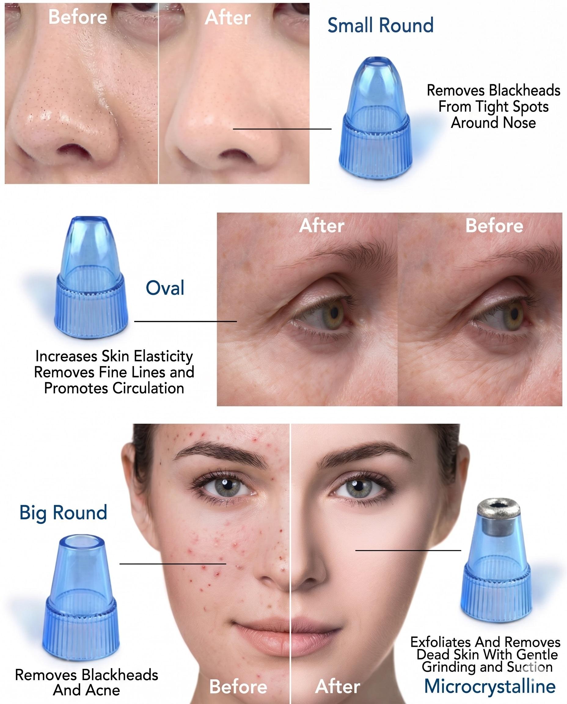skin-011.jpg