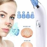 Multi-function Whitehead & Blackhead Remover Tool | Electric Device Machine |(Pack of 1).