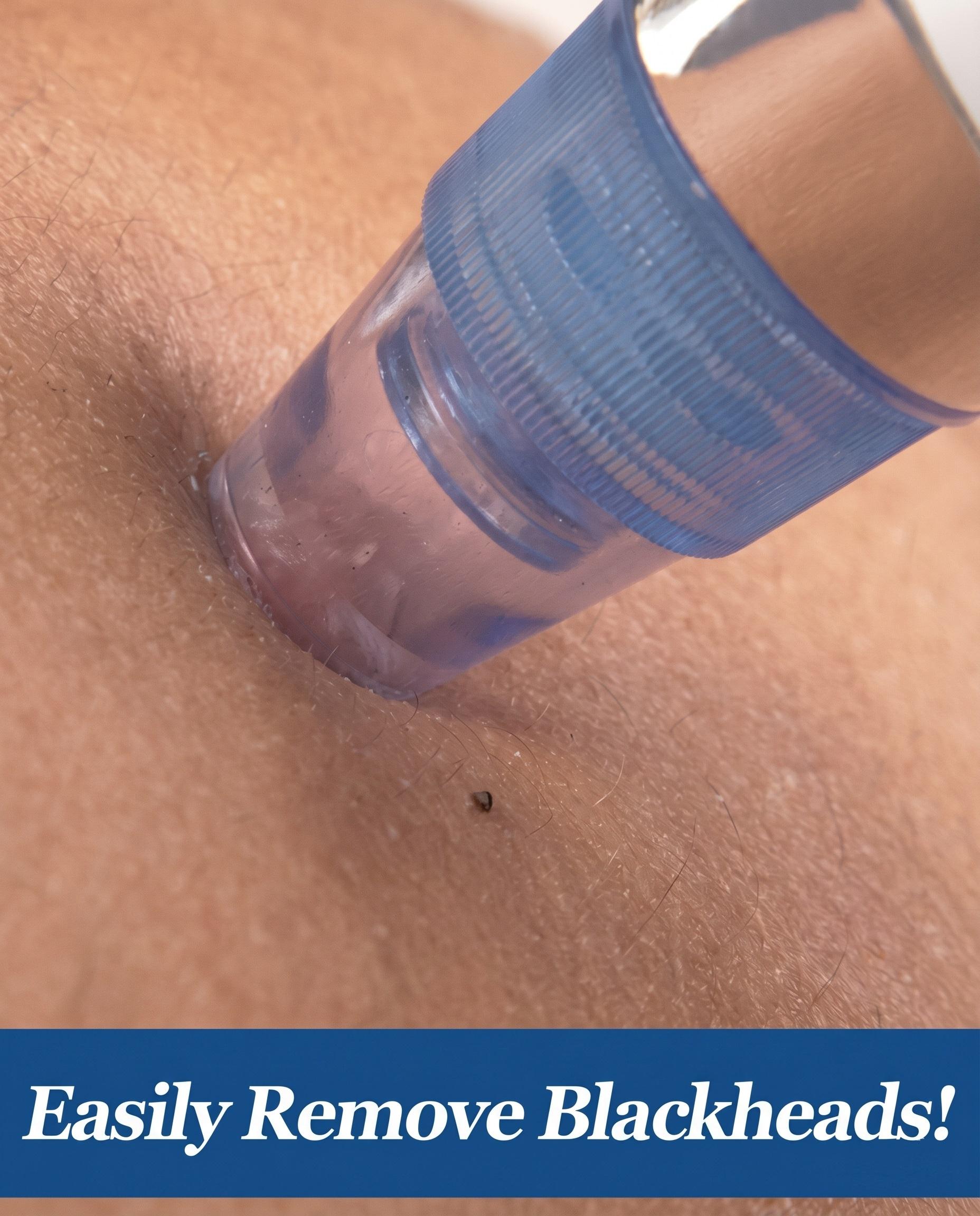 skin-12-1.jpg
