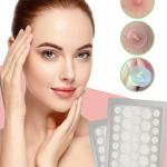 36 Patch Face Acne Pimple Patch - Pack of 1