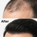 Natural Toppi Hair Building Fibers (Black) 27.5Gm