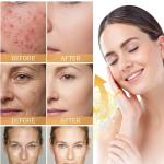 Skin Whitening Soap  For Men and Women  (pack of 1).