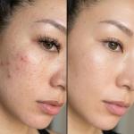Vitamin E Facial Capsules For Glowing Skin 1 Pcs