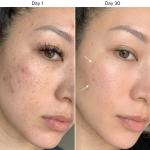 Vitamin E Facial Capsules For Glowing Skin 1 Pcs